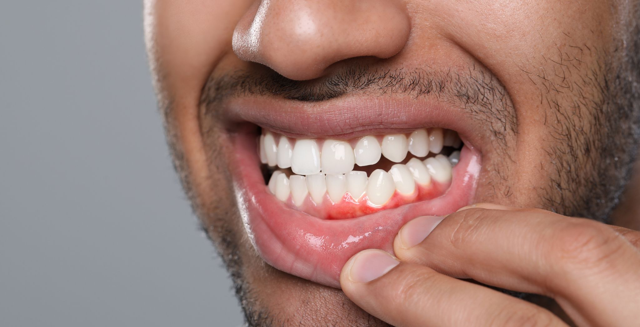 Gum disease treatment in a premium clinic