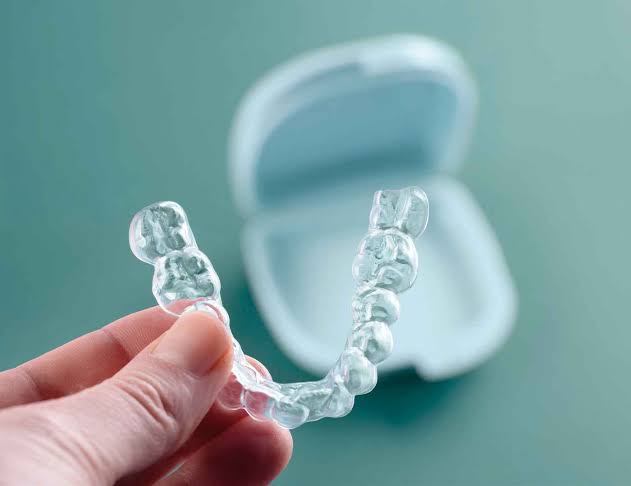 Invisible aligners treatment for a straight smile