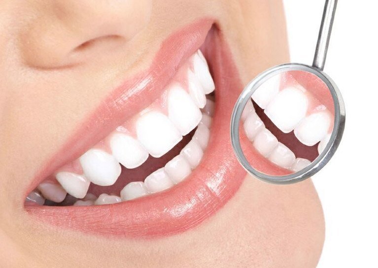 Smile makeover treatment in a premium clinic
